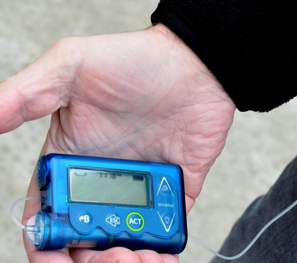 bomba insulina diabetes